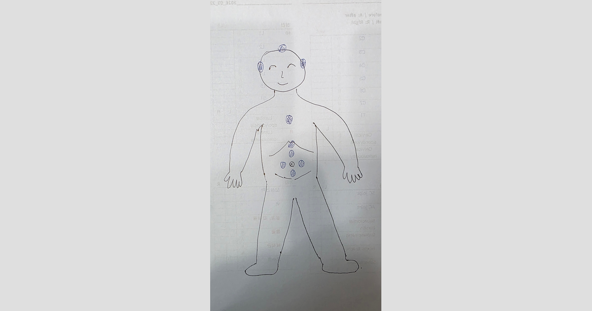 사람의 전신 스케치 위에 머리, 가슴, 복부 등의 주요 혈자리가 파란색 펜으로 표시된 그림