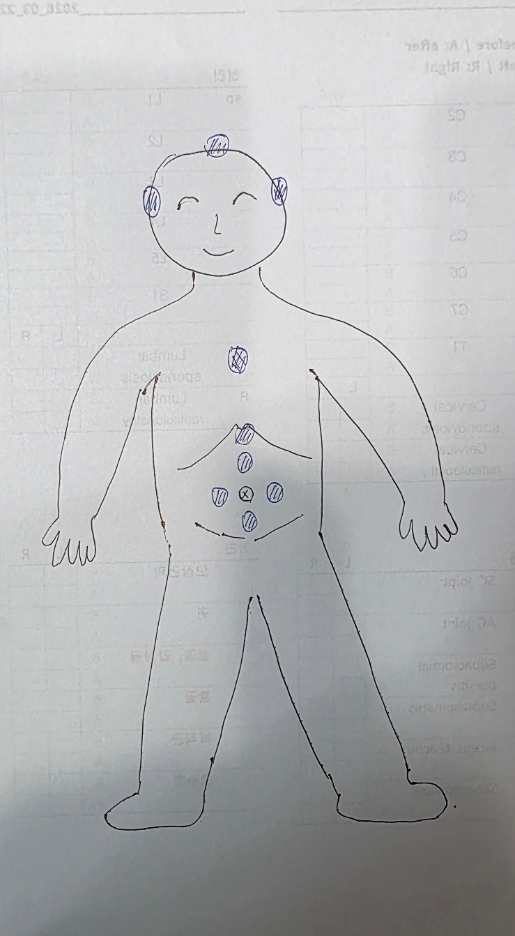 사람의 전신 스케치 위에 머리, 가슴, 복부 등의 주요 혈자리가 파란색 펜으로 표시된 그림